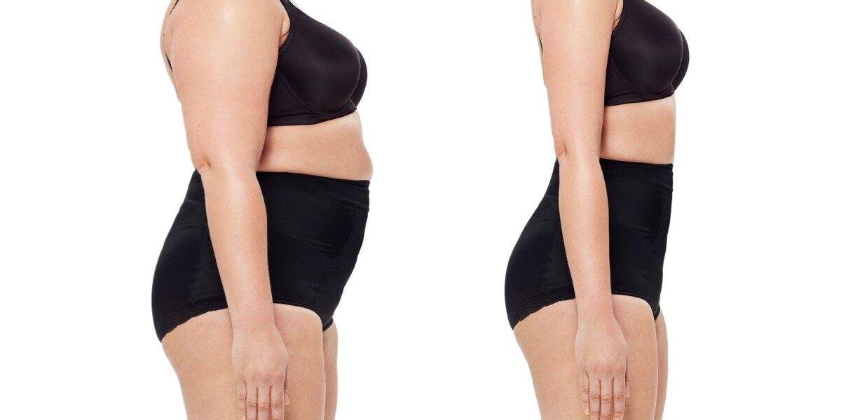 www.hktmay.com_blog_15_Does Fat Freezing Work and Is It Safe?